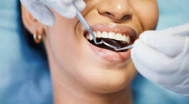 Best Emergency Treatment for Dental Infections or Abscesses in Beaver, UT